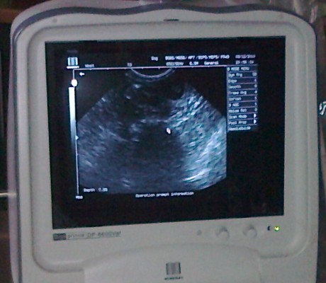 Ultrazvuk 1