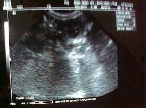 ultrazvuk-ragazza-1-mini.jpg